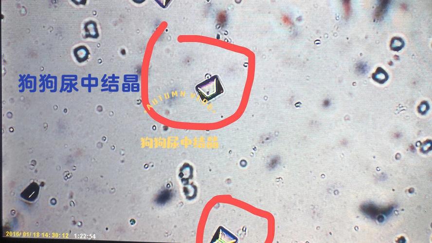 尿磷酸盐结晶类型图片高清_尿液磷酸盐结晶
